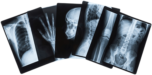 xray